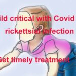 Child critical with Covid and rickettsial infection get timely treatment