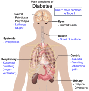 Main Symptoms of diabetes 