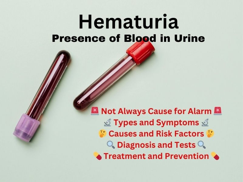 Hematuria - the presence of blood in urine