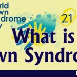 Down syndrome in children - Signs and Symptoms