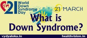  Down syndrome in children - Signs and Symptoms