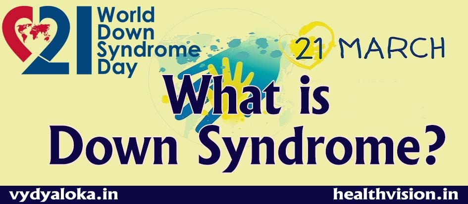 Down-syndrome