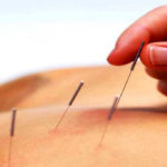 What is Acupuncture and how is it gaining popularity