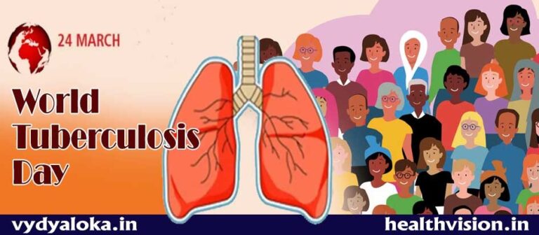 Tuberculosis : 5 Interesting Facts You Should Know - Health Vision