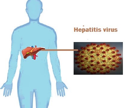 Hepatitis : Things you should know - Diseases Health Vision