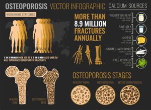 Osteoporosis is increasing