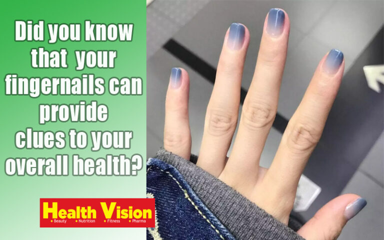 Fingernails Can Provide Clues To Your Overall Health