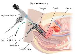 How menstrual disorders can be treated?