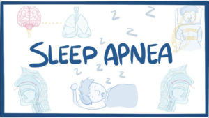 Snoring or Sleep Apnea – The problem and its solutions