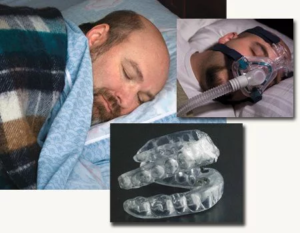 sleep-apnea-oral-appliance-therapy