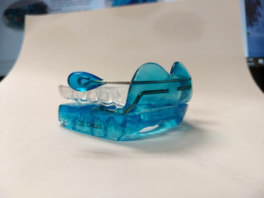 Sleep Apnea Oral Appliance Therapy 3 Health Vision 5719