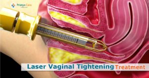 vaginal-tightening-treatment