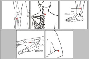 immune system accupuncture - Health Vision