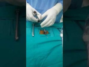 Satnam device for endoscopic surgeries