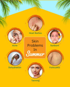 summer-skin