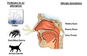 allergy-symptom.