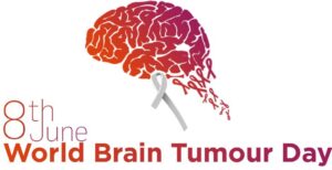Signs of brain tumor you should know; what are the new treatment approaches?