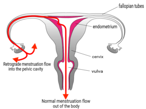 menstruation-bleeding.