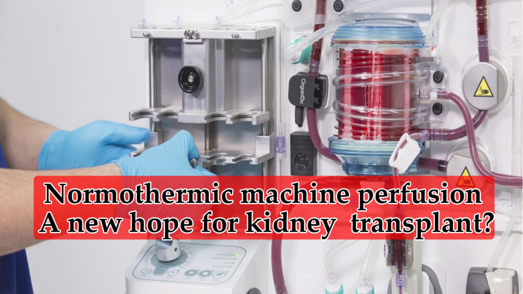 Normothermic-machine-perfusion-a-new-hope-for-kidney-transplant-