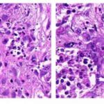 A new approach to tailoring cancer therapy : tapping into signaling activities in cancer cells.
