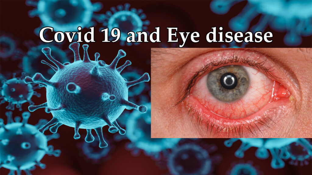 Covid-19-and-eye-disease