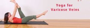 yoga-for-vericose-veins