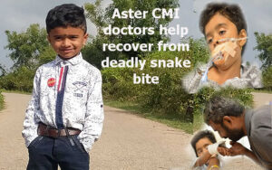 Aster CMI doctors help 5-year-old recover from deadly snake bite.