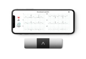 AliveCor brings world’s only six-lead, FDA-cleared personal ECG to India