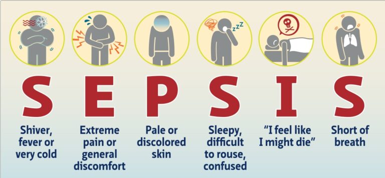 sepsis symptoms - Health Vision