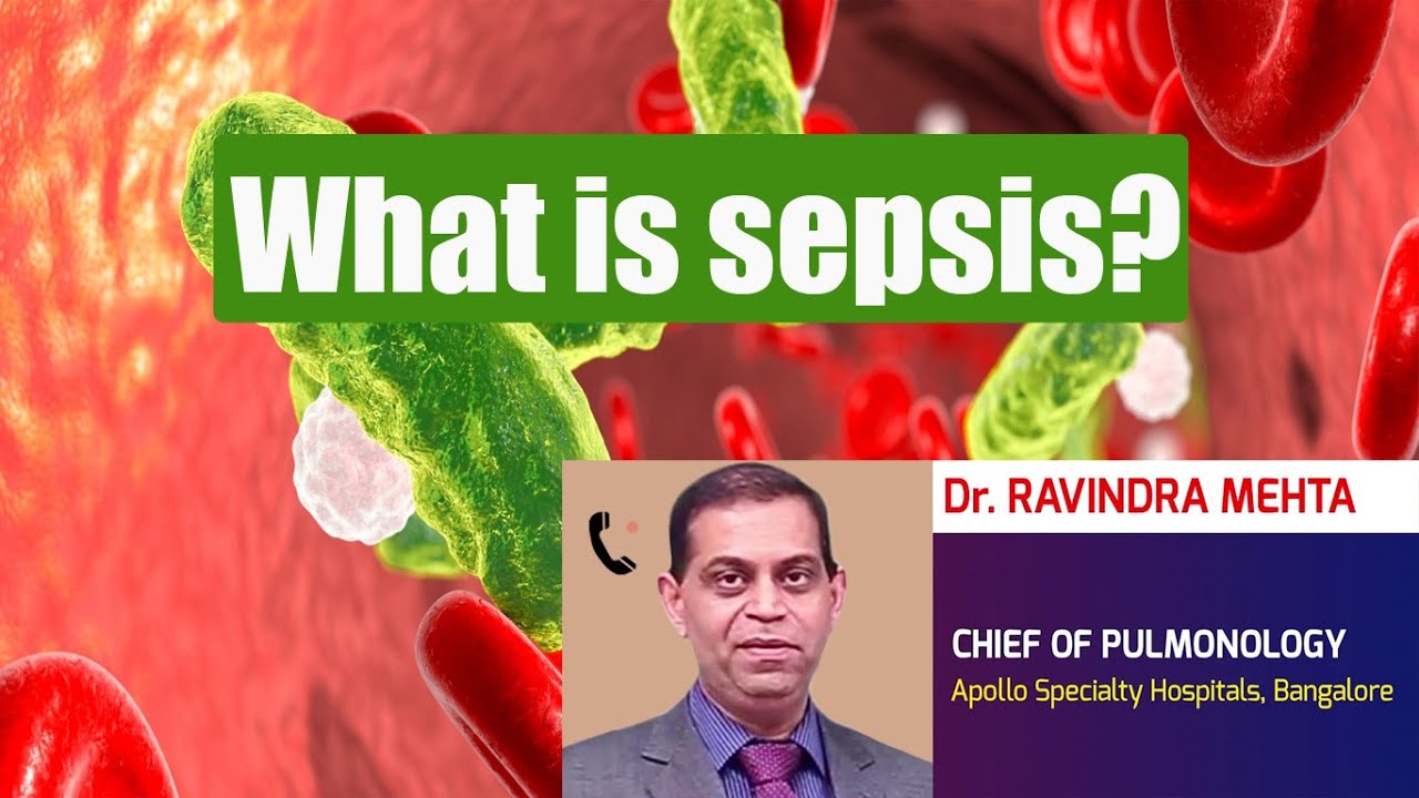 What is sepsis? How to prevent Sepsis? - Health Vision