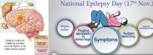 national-epilepsy-day Epilepsy - common chronic disorder of the brain