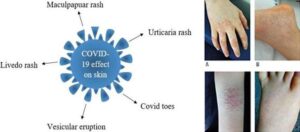 How to tackle stress and skin problems during the Covid-19 pandemic?