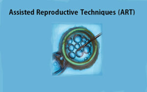 Assisted Reproductive Techniques (ART)