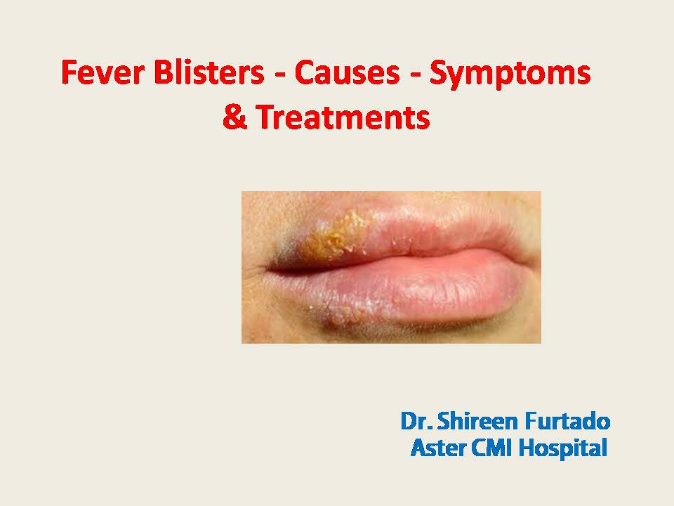 Fever Blisters - Causes - Symptoms and Treatments