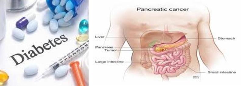 diabetes-and-pancreas
