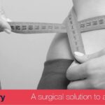 Bariatric Surgery - Let’s fight Obesity together