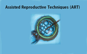 Indira IVF’s successful clinical outcome rate is a result of its cutting-edge ART technology