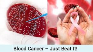 Genetically occurring blood cancer : Lower the risk with change in diet