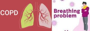 COPD or Chronic obstructive pulmonary disease -how can you live well with it?
