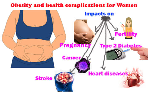 obesity-and-health-complications-in-women