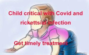 Child critical with Covid and rickettsial infection get timely treatment