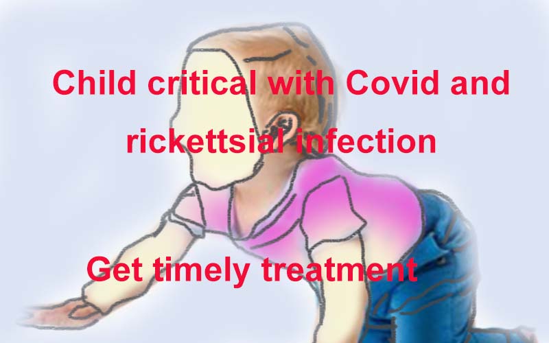 Child critical with Covid and rickettsial infection get timely treatment