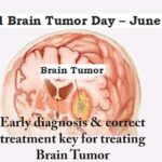 Brain Tumor : Early diagnosis and correct treatment is key for treating
