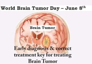 Early diagnosis & correct treatment key for treating Brain Tumor