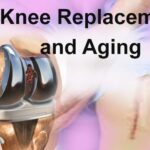 FAQs on Knee Replacement and Aging: both sides of the same coin