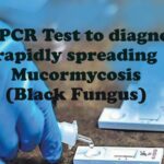 Mucormycosis Multiplex RT-PCR Test to diagnose Black Fungus