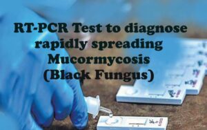 RT-PCR Test to diagnose rapidly spreading Mucormycosis