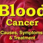 Blood cancer challenges faced in terms Of diagnosis and treatment In India