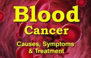 Blood cancer challenges faced in terms Of diagnosis and treatment In India
