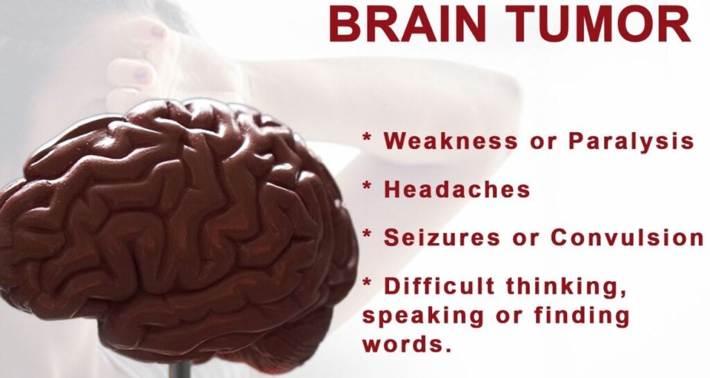 brain-tumor